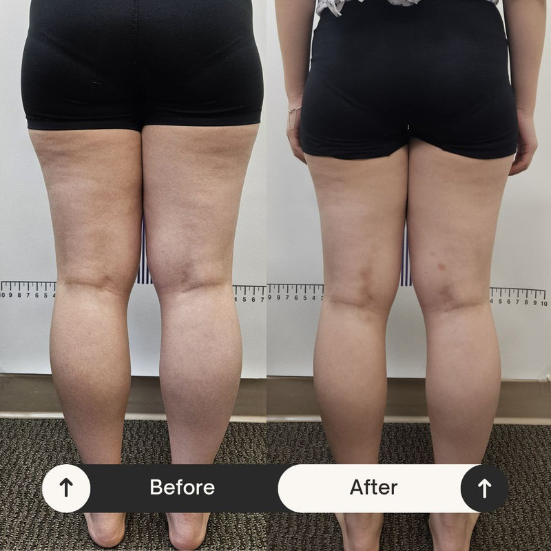 How This Woman Lost Weight, Reduced Cellulite, and Got Healthier